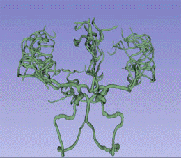 Vessel segmentation
