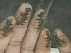 Altered fingerprint
